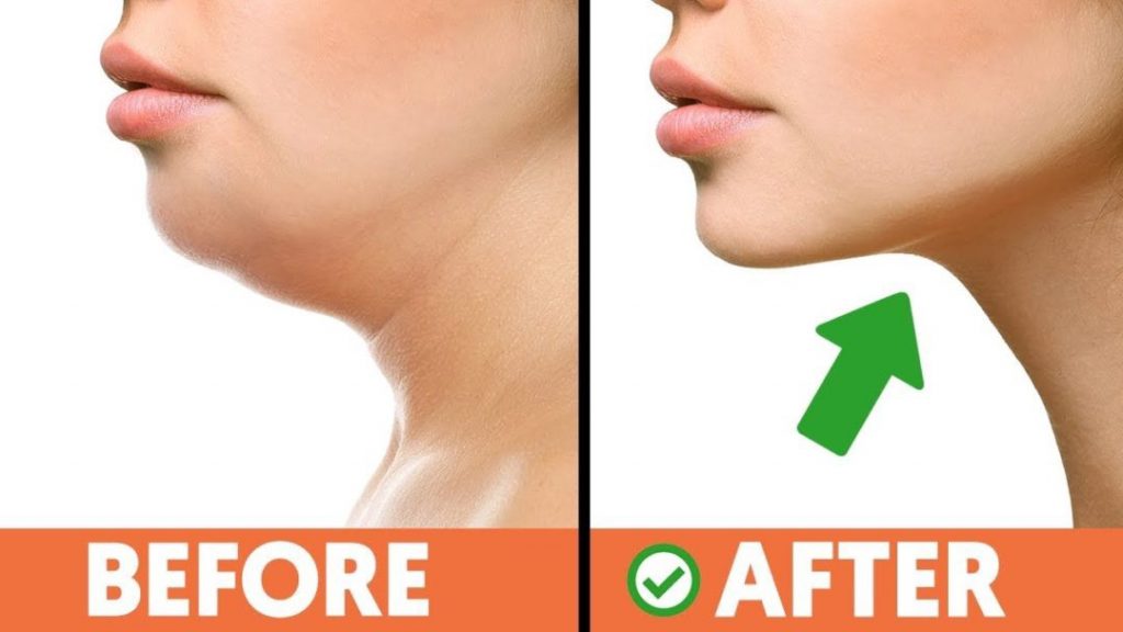 Jawline Exercise: How To Get A Chiseled Jawline | Lifestyle By CyberTecz